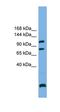 Serine/threonine-protein phosphatase 6 regulatory subunit 1 antibody, orb325961, Biorbyt, Western Blot image 