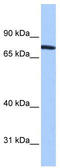 Zinc Finger Protein 45 antibody, TA339071, Origene, Western Blot image 
