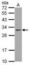 TP53 Induced Glycolysis Regulatory Phosphatase antibody, LS-C155465, Lifespan Biosciences, Western Blot image 