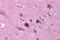 BCL2 Family Apoptosis Regulator BOK antibody, A05577, Boster Biological Technology, Western Blot image 
