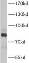 Ankyrin repeat and zinc finger domain-containing protein 1 antibody, FNab00424, FineTest, Western Blot image 