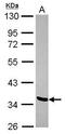 LIM Domain Binding 2 antibody, GTX116344, GeneTex, Western Blot image 