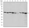 Chaperonin Containing TCP1 Subunit 2 antibody, NBP2-37561, Novus Biologicals, Western Blot image 