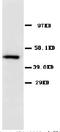 Solute Carrier Family 2 Member 4 antibody, PA1039, Boster Biological Technology, Western Blot image 