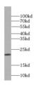 Cysteine Dioxygenase Type 1 antibody, FNab02183, FineTest, Western Blot image 