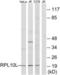 Ribosomal Protein L10 antibody, LS-C119654, Lifespan Biosciences, Western Blot image 