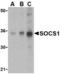 Suppressor Of Cytokine Signaling 1 antibody, TA306304, Origene, Western Blot image 