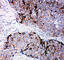 Metalloproteinase inhibitor 2 antibody, PA1076, Boster Biological Technology, Western Blot image 