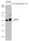 X-Box Binding Protein 1 antibody, GTX122156, GeneTex, Western Blot image 