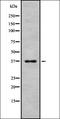Retinal Pigment Epithelium-Derived Rhodopsin Homolog antibody, orb378369, Biorbyt, Western Blot image 