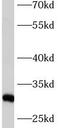 ASB-9 antibody, FNab00625, FineTest, Western Blot image 