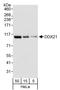 DExD-Box Helicase 21 antibody, A300-627A, Bethyl Labs, Western Blot image 