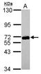 Zinc Finger Protein 587 antibody, NBP2-21031, Novus Biologicals, Western Blot image 