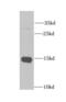 CRABP-II antibody, FNab01951, FineTest, Western Blot image 
