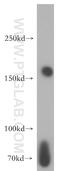 Nuclear pore complex protein Nup153 antibody, 14189-1-AP, Proteintech Group, Western Blot image 