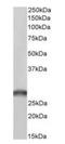 Succinate Dehydrogenase Complex Iron Sulfur Subunit B antibody, orb334074, Biorbyt, Western Blot image 