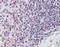 CD70 Molecule antibody, orb96689, Biorbyt, Immunohistochemistry paraffin image 