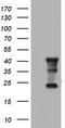 Transmembrane Protein 173 antibody, CF505024, Origene, Western Blot image 