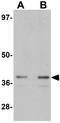 Zinc transporter ZIP1 antibody, GTX85135, GeneTex, Western Blot image 