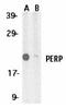 P53 Apoptosis Effector Related To PMP22 antibody, TA306075, Origene, Western Blot image 