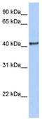 Doublesex- and mab-3-related transcription factor 1 antibody, TA330051, Origene, Western Blot image 