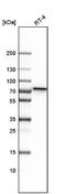 Polypeptide N-acetylgalactosaminyltransferase 1 antibody, NBP1-81852, Novus Biologicals, Western Blot image 