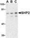 Protein Tyrosine Phosphatase Non-Receptor Type 11 antibody, AHP1198, Bio-Rad (formerly AbD Serotec) , Western Blot image 