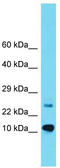 Uncharacterized protein C8orf31 antibody, TA334854, Origene, Western Blot image 