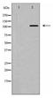 BUB1 Mitotic Checkpoint Serine/Threonine Kinase antibody, TA347945, Origene, Western Blot image 