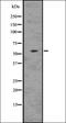 Protein Mdm4 antibody, orb336619, Biorbyt, Western Blot image 