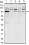 Serine/threonine-protein kinase/endoribonuclease IRE1 antibody, GTX82996, GeneTex, Western Blot image 