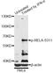 p65 antibody, AP0445, ABclonal Technology, Western Blot image 