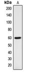 DNA Cross-Link Repair 1B antibody, LS-C353534, Lifespan Biosciences, Western Blot image 