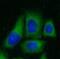 Protein Phosphatase 2 Regulatory Subunit Bbeta antibody, FNab06717, FineTest, Immunofluorescence image 