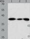 Aldo-Keto Reductase Family 1 Member A1 antibody, TA324137, Origene, Western Blot image 