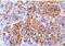 Melan-A antibody, AM50291PU-T, Origene, Immunohistochemistry paraffin image 