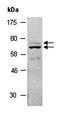 Matrix metalloproteinase-17 antibody, orb67217, Biorbyt, Western Blot image 