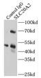 Sodium-dependent phosphate transporter 2 antibody, FNab07918, FineTest, Immunoprecipitation image 