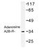 Adenosine A2b Receptor antibody, AP01260PU-N, Origene, Western Blot image 