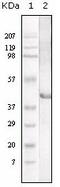 Lipase A, Lysosomal Acid Type antibody, AM06118PU-N, Origene, Western Blot image 