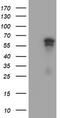 Adrenocortical dysplasia protein homolog antibody, TA504406, Origene, Western Blot image 