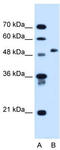 Collagen alpha-2(VI) chain antibody, TA338916, Origene, Western Blot image 