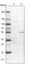 Decaprenyl Diphosphate Synthase Subunit 2 antibody, PA5-56231, Invitrogen Antibodies, Western Blot image 