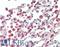 Adenine Phosphoribosyltransferase antibody, LS-B10419, Lifespan Biosciences, Immunohistochemistry frozen image 