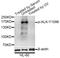 ALK Receptor Tyrosine Kinase antibody, AP0503, ABclonal Technology, Western Blot image 