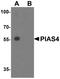 Protein Inhibitor Of Activated STAT 4 antibody, A02994, Boster Biological Technology, Western Blot image 