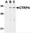 C1q And TNF Related 4 antibody, 3569, ProSci, Western Blot image 