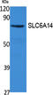 Solute Carrier Family 6 Member 14 antibody, STJ96467, St John