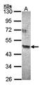 Acyl-CoA Dehydrogenase Family Member 8 antibody, orb73398, Biorbyt, Western Blot image 
