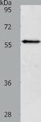VANGL Planar Cell Polarity Protein 2 antibody, TA322268, Origene, Western Blot image 